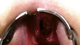 Kurus jolok dalam re ...